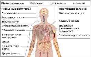 Схема с перечнем симптомов Covid-19